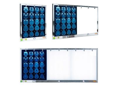 ĐÈN ĐỌC PHIM Y KHOA